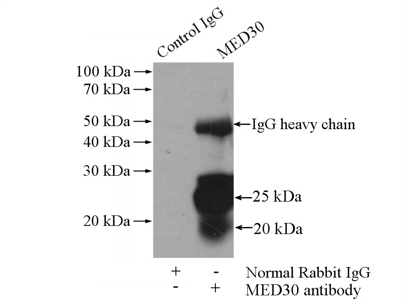 IP Result of anti-MED30 (IP:Catalog No:112590, 4ug; Detection:Catalog No:112590 1:500) with mouse heart tissue lysate 4000ug.