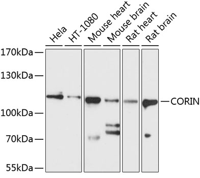 Western blot - CORIN Polyclonal Antibody 