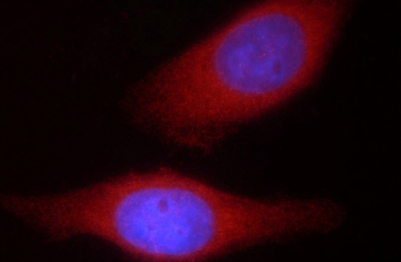 Immunofluorescent analysis of HepG2 cells using Catalog No:110125(DVL2 Antibody) at dilution of 1:50 and Rhodamine-Goat anti-Rabbit IgG