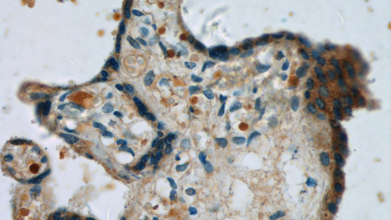Immunohistochemistry of paraffin-embedded human placenta tissue slide using Catalog No:117041(ZFP36L1 Antibody) at dilution of 1:50 (under 40x lens)