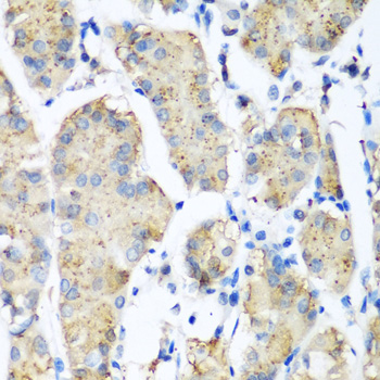 Immunohistochemistry - PLEK Polyclonal Antibody 