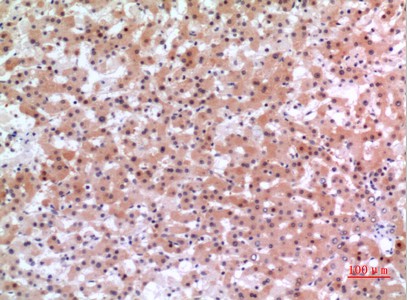 Fig2:; Immunohistochemical analysis of paraffin-embedded human-liver, antibody was diluted at 1:100