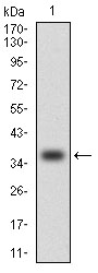 Fig1: Western blot analysis of CCL2 on human CCL2 recombinant protein using anti-CCL2 antibody at 1/1,000 dilution.