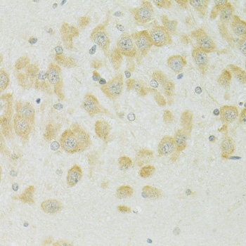 Immunohistochemistry - SLC37A4 Polyclonal Antibody 