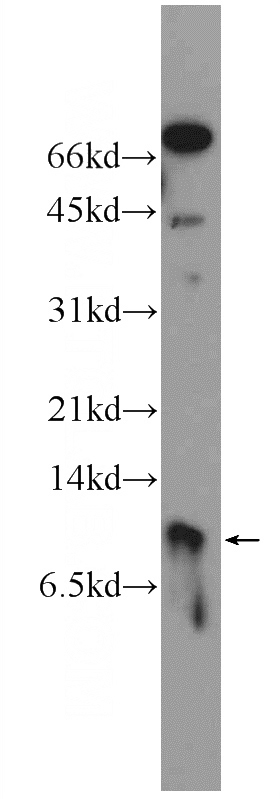 mouse brain tissue were subjected to SDS PAGE followed by western blot with Catalog No:109653(CXorf61 Antibody) at dilution of 1:600