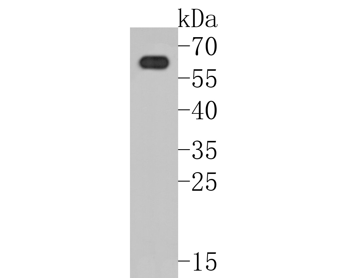Fig1:; Western blot analysis of PAK3 on rat brain tissue lysates. Proteins were transferred to a PVDF membrane and blocked with 5% BSA in PBS for 1 hour at room temperature. The primary antibody ( 1/500) was used in 5% BSA at room temperature for 2 hours. Goat Anti-Rabbit IgG - HRP Secondary Antibody (HA1001) at 1:5,000 dilution was used for 1 hour at room temperature.