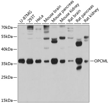 Western blot - OPCML Polyclonal Antibody 