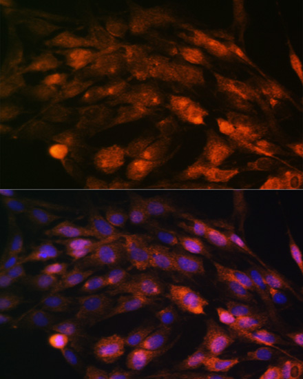 Immunofluorescence - PTCH1 Polyclonal Antibody 
