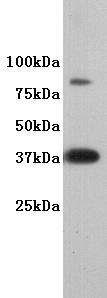 Fig1:; Western blot analysis on F9 using anti-DPPA2 polyclonal antibody