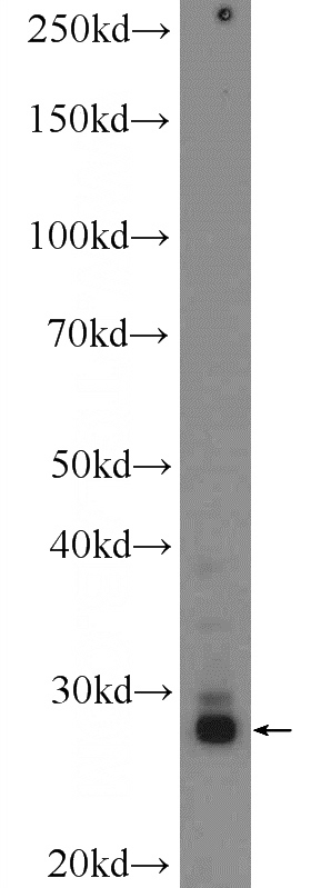 fetal human brain tissue were subjected to SDS PAGE followed by western blot with Catalog No:117113(BDNF Antibody) at dilution of 1:300