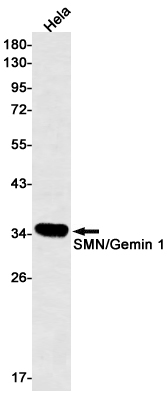 Western blot detection of SMN/Gemin 1 in Hela cell lysates using SMN/Gemin 1 Rabbit mAb(1:500 diluted).Predicted band size:32kDa.Observed band size:35kDa.
