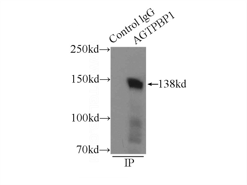 IP Result of anti-CCP1 (IP:Catalog No:109072, 3ug; Detection:Catalog No:109072 1:1000) with mouse testis tissue lysate 10000ug.