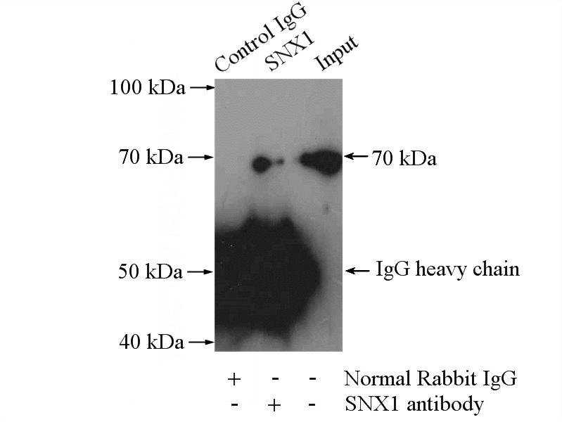 IP Result of anti-SNX1 (IP:Catalog No:115469, 4ug; Detection:Catalog No:115469 1:800) with HeLa cells lysate 2000ug.