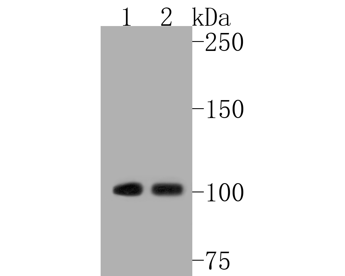 Fig1:; Western blot analysis of Ubiquitin-like modifier-activating enzyme 1 on different lysates. Proteins were transferred to a PVDF membrane and blocked with 5% BSA in PBS for 1 hour at room temperature. The primary antibody ( 1/500) was used in 5% BSA at room temperature for 2 hours. Goat Anti-Rabbit IgG - HRP Secondary Antibody (HA1001) at 1:5,000 dilution was used for 1 hour at room temperature.; Positive control:; Lane 1: mouse kidney tissue lysate; Lane 2: mouse liver tissue lysate