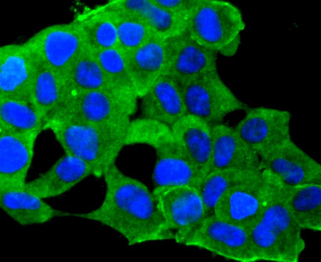 Fig5:; ICC staining of IGF2 in 293 cells (green). Formalin fixed cells were permeabilized with 0.1% Triton X-100 in TBS for 10 minutes at room temperature and blocked with 10% negative goat serum for 15 minutes at room temperature. Cells were probed with the primary antibody ( 1/50) for 1 hour at room temperature, washed with PBS. Alexa Fluor®488 conjugate-Goat anti-Rabbit IgG was used as the secondary antibody at 1/1,000 dilution. The nuclear counter stain is DAPI (blue).