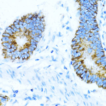 Immunohistochemistry - NOX1 Polyclonal Antibody 