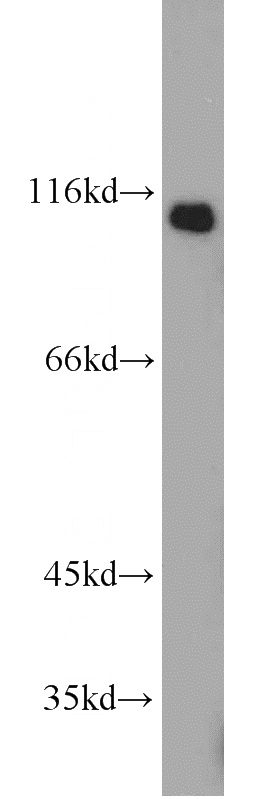 human liver tissue were subjected to SDS PAGE followed by western blot with Catalog No:107956(ALCAM antibody) at dilution of 1:500