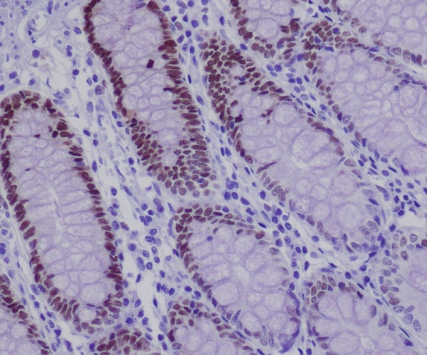 Immunohistochemical analysis of paraffin-embedded human colon, using SOX9 Antibody .