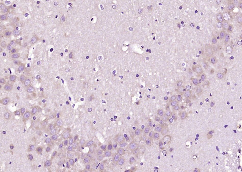 Fig2: Paraformaldehyde-fixed, paraffin embedded (rat brain tissue); Antigen retrieval by boiling in sodium citrate buffer (pH6.0) for 15min; Block endogenous peroxidase by 3% hydrogen peroxide for 20 minutes; Blocking buffer (normal goat serum) at 37℃ for 30min; Antibody incubation with (STK40) Polyclonal Antibody, Unconjugated at 1:200 overnight at 4℃, followed by operating according to SP Kit(Rabbit) (sp-0023) instructionsand DAB staining.
