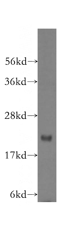 HepG2 cells were subjected to SDS PAGE followed by western blot with Catalog No:112845(MRPS18A antibody) at dilution of 1:300