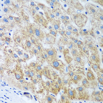 Immunohistochemistry - UBE2U Polyclonal Antibody 
