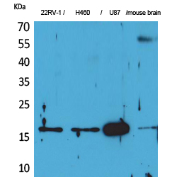 Fig1:; Western Blot analysis of 22RV-1, H460, U87, mouse brain cells using Apelin Polyclonal Antibody.. Secondary antibody（catalog#：HA1001) was diluted at 1:20000