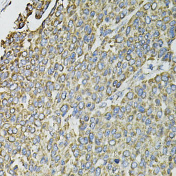Immunohistochemistry - RASSF1 Polyclonal Antibody 