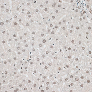 Immunohistochemistry - CBX6 Polyclonal Antibody 