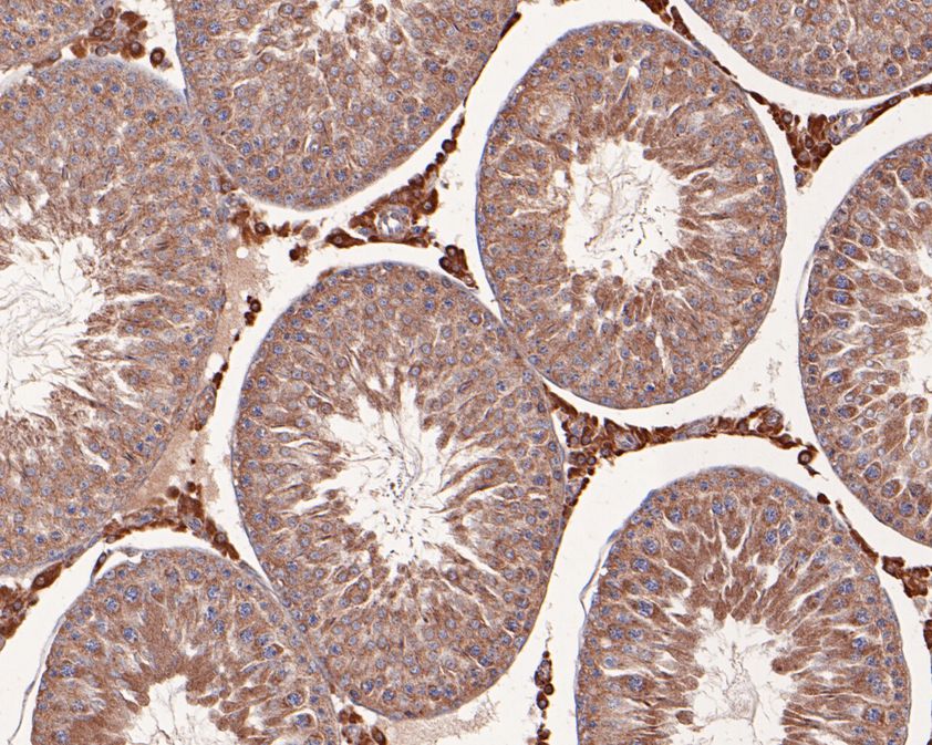 Fig2:; Immunohistochemical analysis of paraffin-embedded rat testis tissue using anti-NMBR antibody. The section was pre-treated using heat mediated antigen retrieval with Tris-EDTA buffer (pH 9.0) for 20 minutes.The tissues were blocked in 1% BSA for 30 minutes at room temperature, washed with ddH; 2; O and PBS, and then probed with the primary antibody ( 1/400) for 30 minutes at room temperature. The detection was performed using an HRP conjugated compact polymer system. DAB was used as the chromogen. Tissues were counterstained with hematoxylin and mounted with DPX.