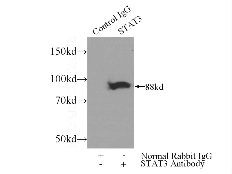 IP Result of anti-STAT3 (IP:Catalog No:115688, 3ug; Detection:Catalog No:115688 1:2000) with HeLa cells lysate 3000ug.