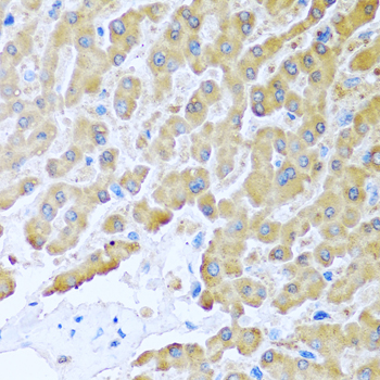 Immunohistochemistry - CCL8 Polyclonal Antibody 