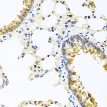 Immunohistochemistry - WNT9A Polyclonal Antibody 