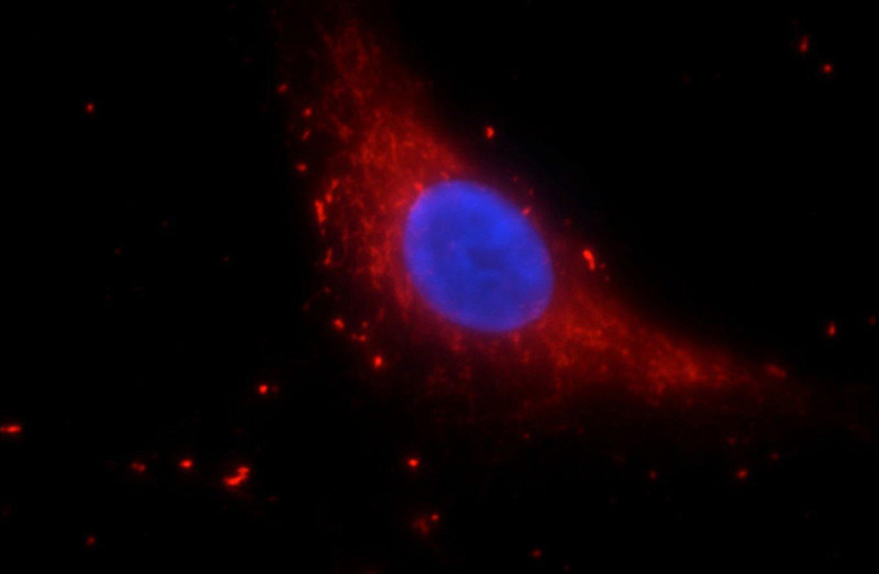 Immunofluorescent analysis of A549 cells using Catalog No:109961(DNASE2B Antibody) at dilution of 1:25 and Rhodamine-Goat anti-Rabbit IgG