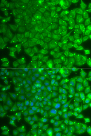 Immunofluorescence - KBTBD7 Polyclonal Antibody 