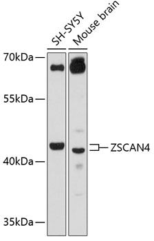 Western blot - ZSCAN4 Polyclonal Antibody 