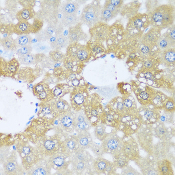 Immunohistochemistry - BRSK1 Polyclonal Antibody 