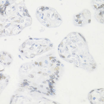 Immunohistochemistry - CREM Polyclonal Antibody 