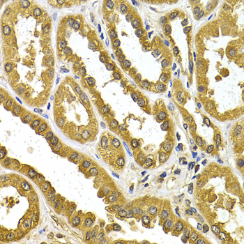 Immunohistochemistry - UGT1A4 Polyclonal Antibody 