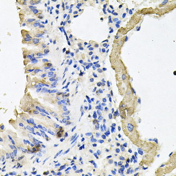 Immunohistochemistry - MYH7 Polyclonal Antibody 