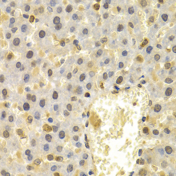 Immunohistochemistry - UBD Polyclonal Antibody 