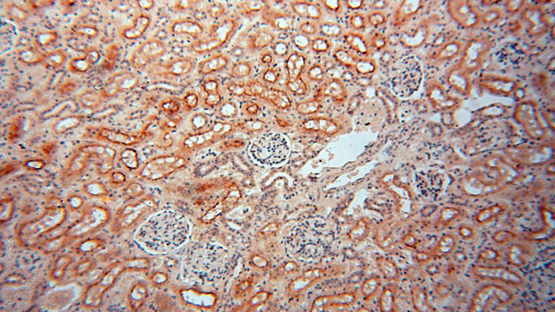 Immunohistochemical of paraffin-embedded human kidney using Catalog No:107931(AKAP14 antibody) at dilution of 1:50 (under 10x lens)