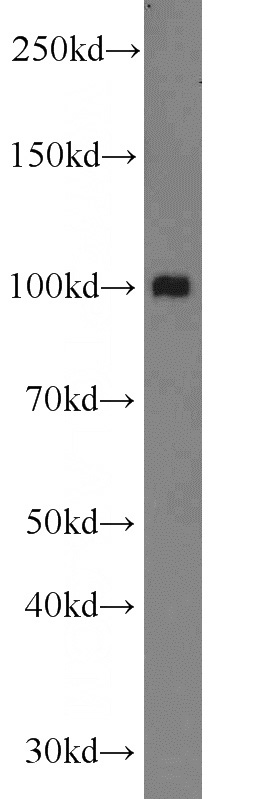 mouse kidney tissue were subjected to SDS PAGE followed by western blot with Catalog No:112776(MTHFD1 antibody) at dilution of 1:600
