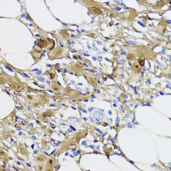 Immunohistochemistry - COL1A1 Polyclonal Antibody 