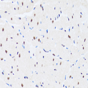 Immunohistochemistry - MTA3 Polyclonal Antibody 