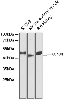 Western blot - KCNJ4 Polyclonal Antibody 
