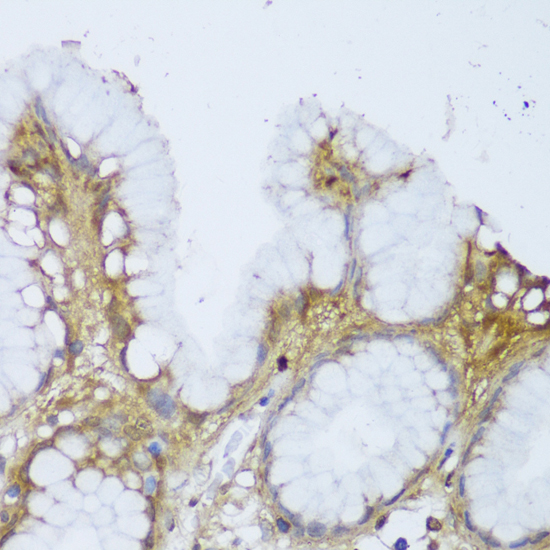 Immunohistochemistry - GCN1L1 Polyclonal Antibody 