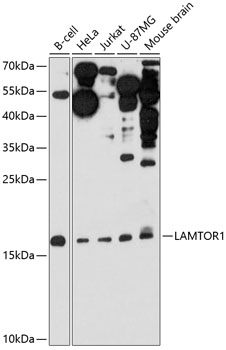 Western blot - LAMTOR1 Polyclonal Antibody 