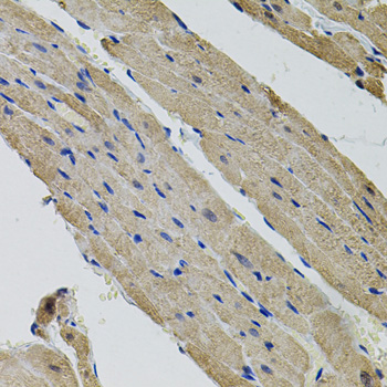 Immunohistochemistry - ALDH9A1 Polyclonal Antibody 