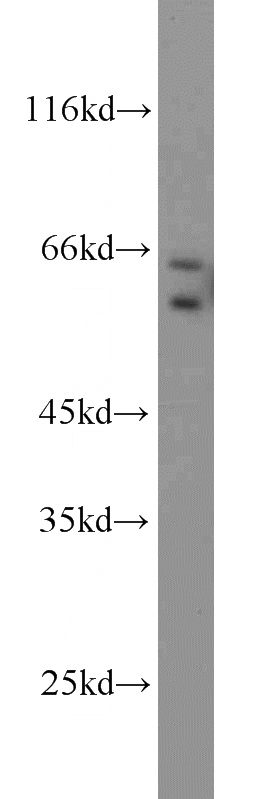 A549 cells were subjected to SDS PAGE followed by western blot with Catalog No:112696(MMP1 antibody) at dilution of 1:1000