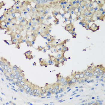 Immunohistochemistry - NEDD4L Polyclonal Antibody 